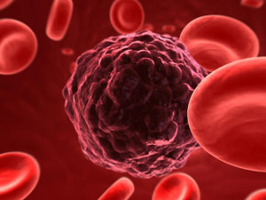 Un accidente vascular cerebral hemorrágico (derrame cerebral) ocurre cuando el cerebro no recibe suficiente sangre y oxígeno, lo que genera la muerte de células.